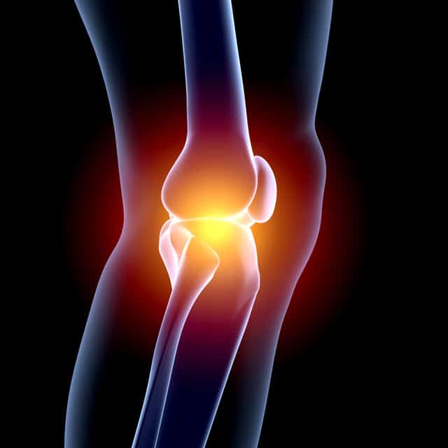 knee injury image