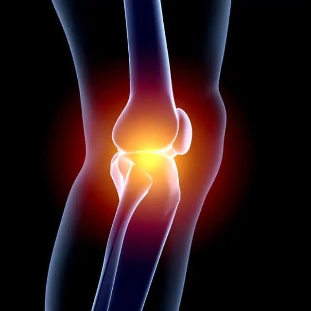 3D image of knee injury lawyer Austin