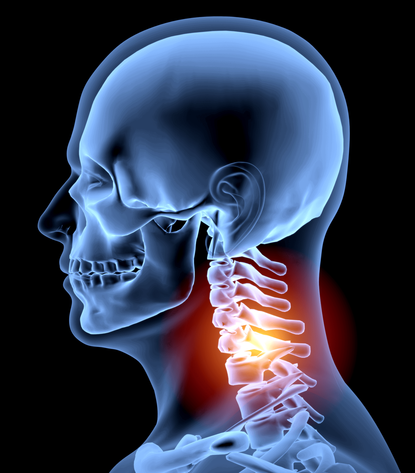 Can A Neck Injury Cause Brain Damage