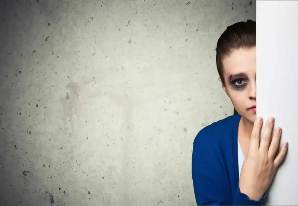 Female subjected to possible eye injury or loss due to car accident.