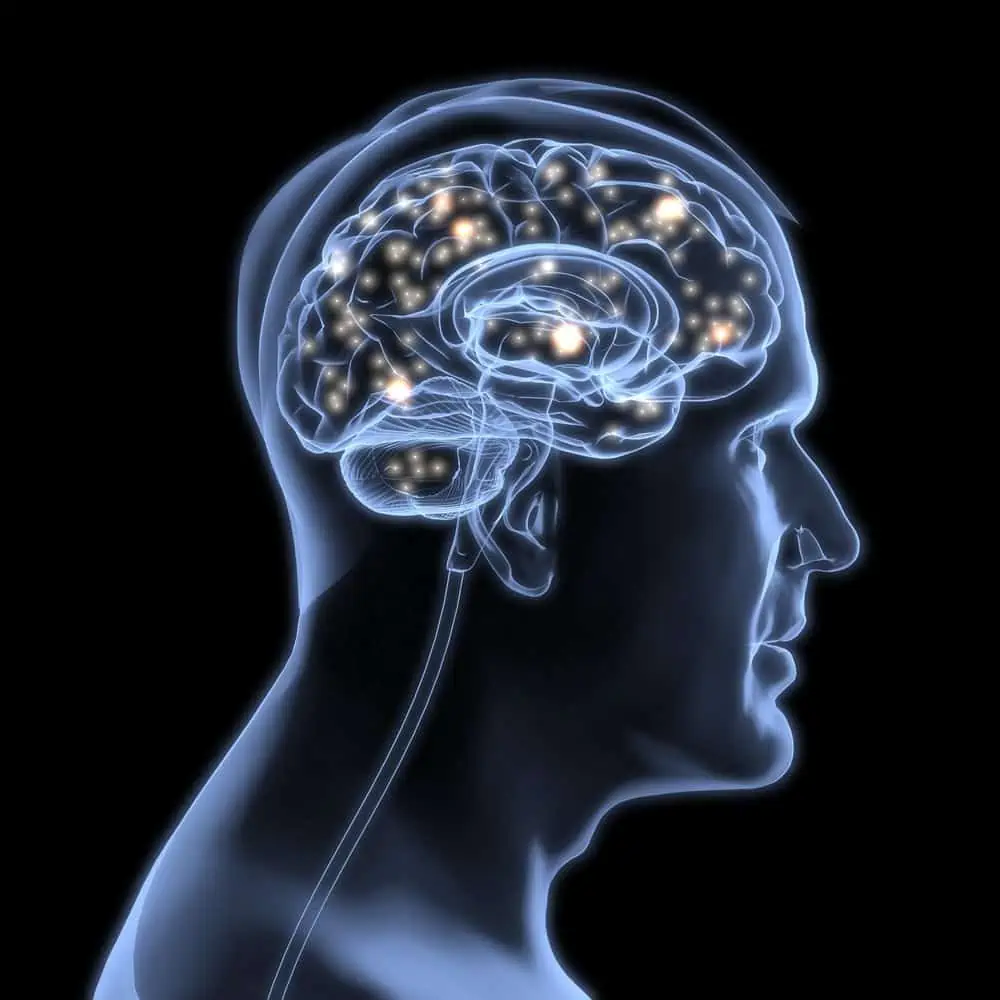 traumatic brain injury image