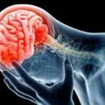 photo representation for mild traumatic brain injuries