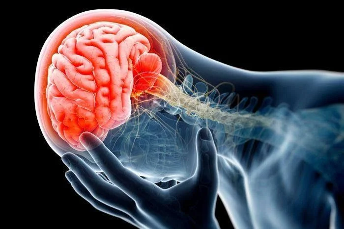 photo representation of mild traumatic brain injuries