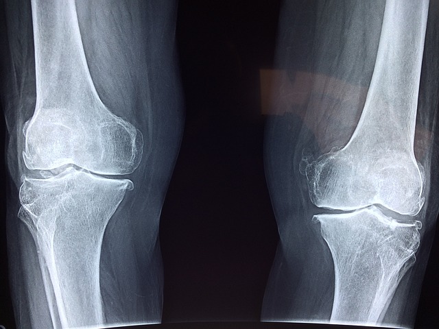 compensation in a knee injury