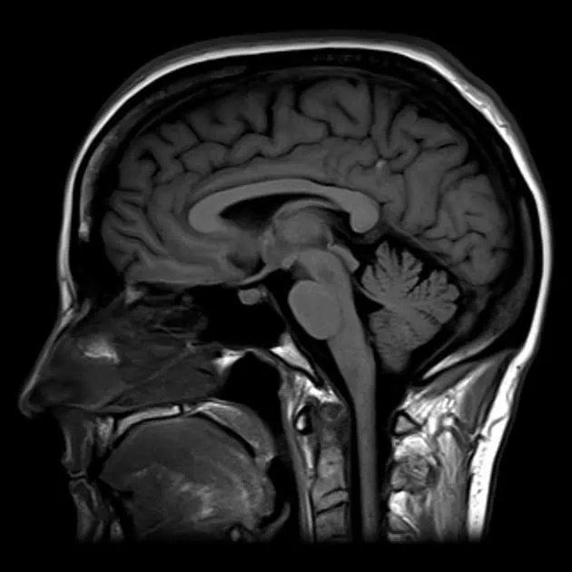 brain image
